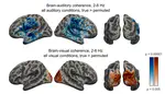 Differential auditory and visual phase-locking are observed during audio-visual benefit and silent lip-reading for speech perception